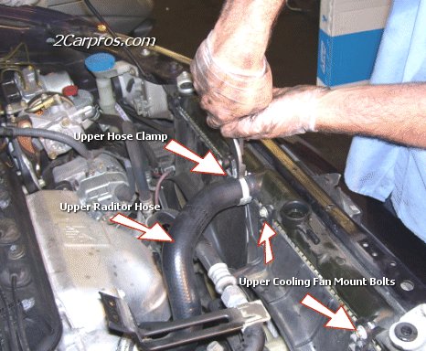 Remove Upper Radiator Hose Connections
