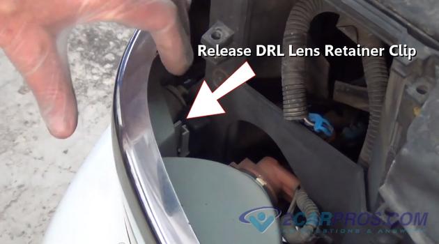 release drl lens retainer clip