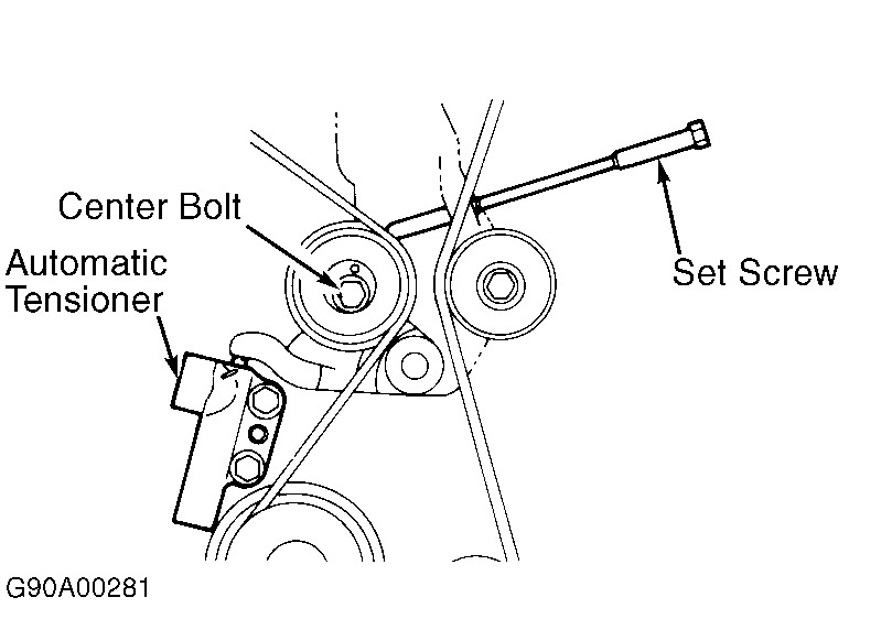 How Do U Install a Sonata Timing Belt